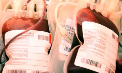 Photo of bags of plasma concentrate and blood