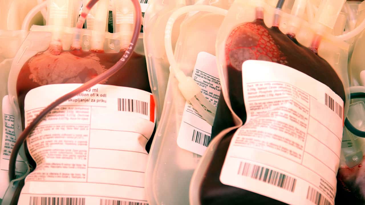 Photo of bags of plasma concentrate and blood